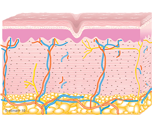 Collagen Remodeling Occurs | Skin Tightening